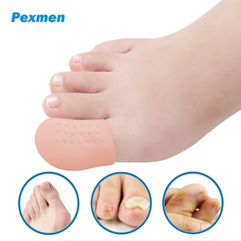 Pexmen 2 елемента Гел Капачки за големия пръст на Крака Протектор Дишащи Ръкави Осигуряват Облекчаване на болката, при Липса на Врастнали нокти на краката си Мехури